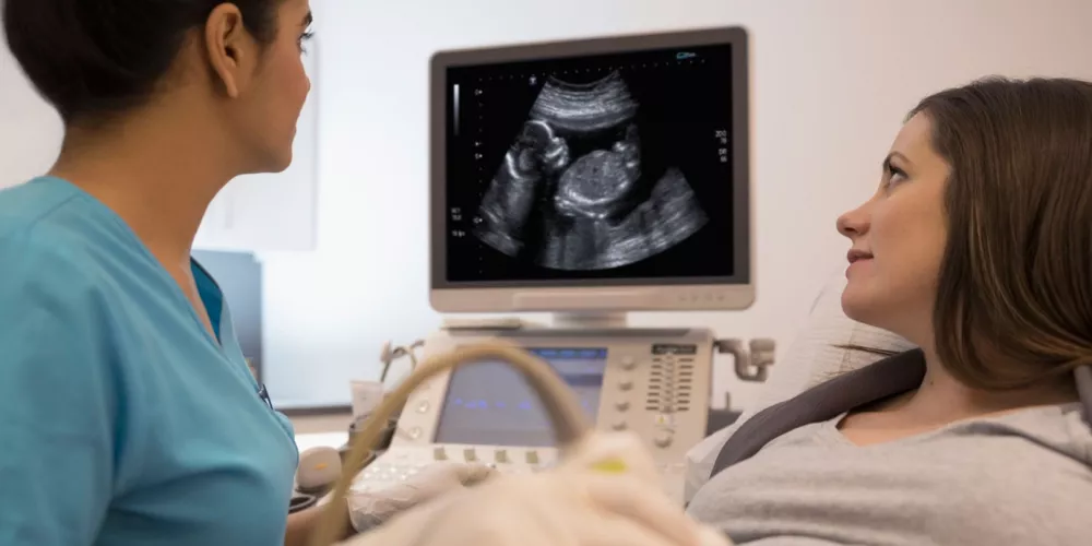 معرفة نوع الجنين من الشهر الأول بالسونار