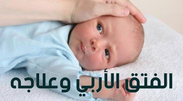 اعراض الفتق الأربي عند الرضع