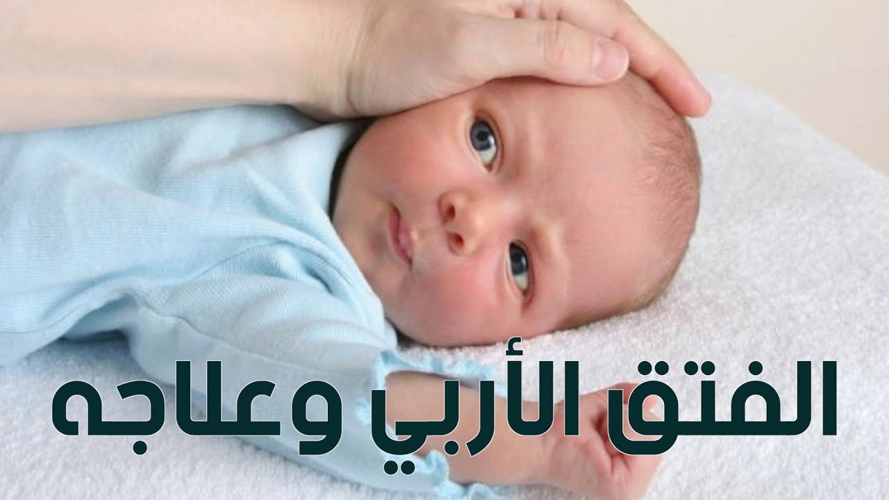 اعراض الفتق الأربي عند الرضع