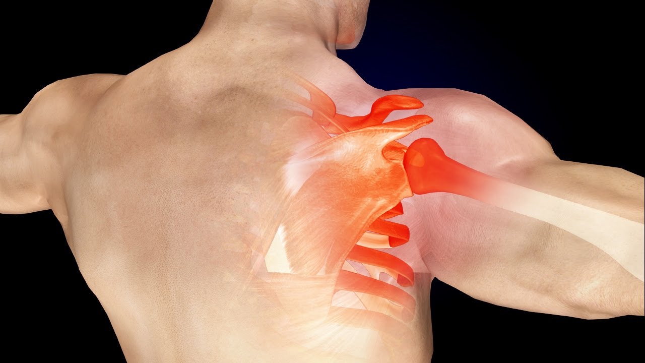 أسباب ألم في الكتف الأيسر من الخلف وعلاجه