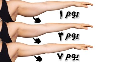 تجربتي مع عملية شد الذراعين