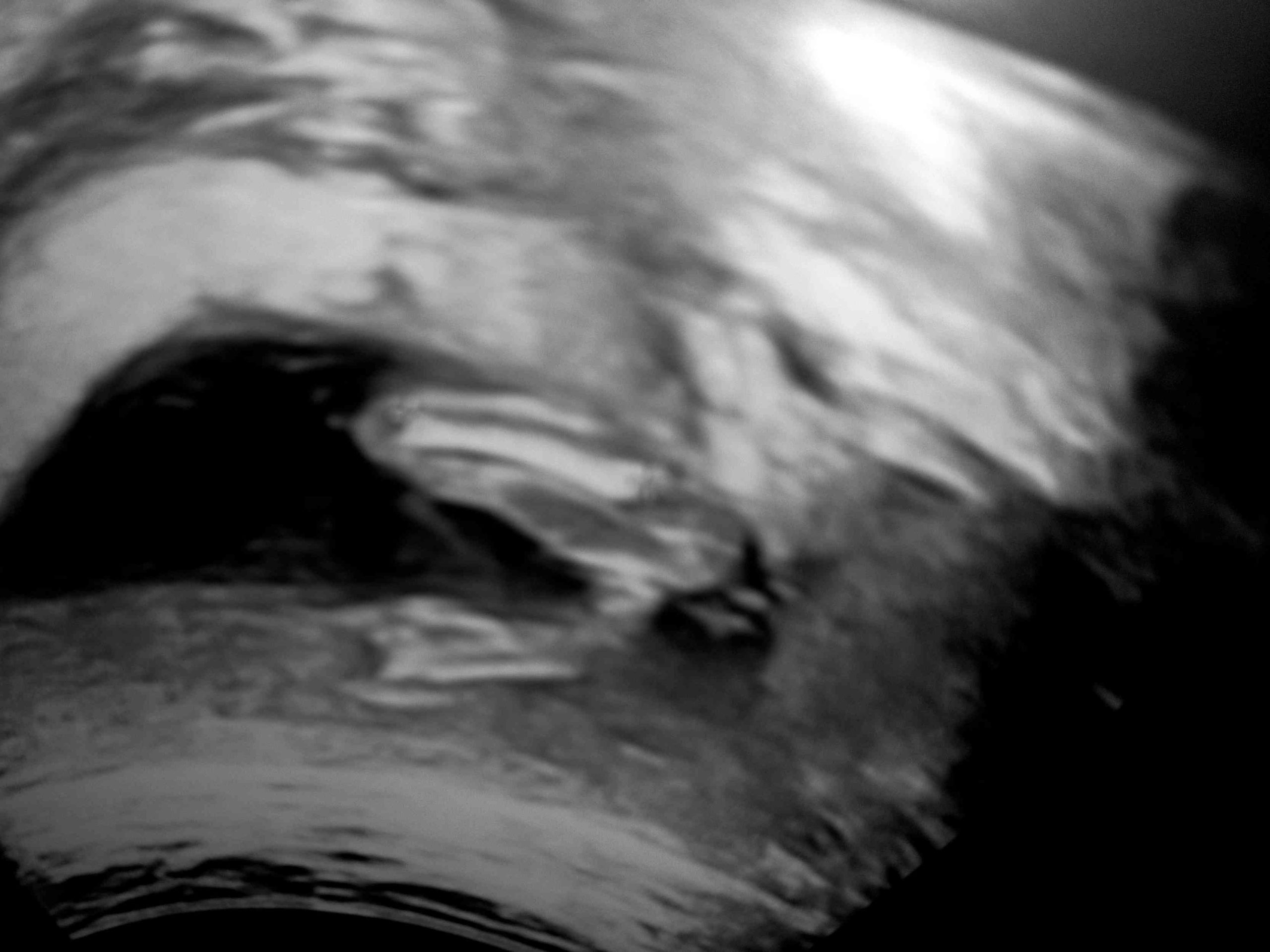 متى يظهر الحمل بتوأم في كيس واحد بالسونار