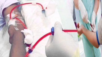 متى يتوقف المريض عن غسيل الكلى