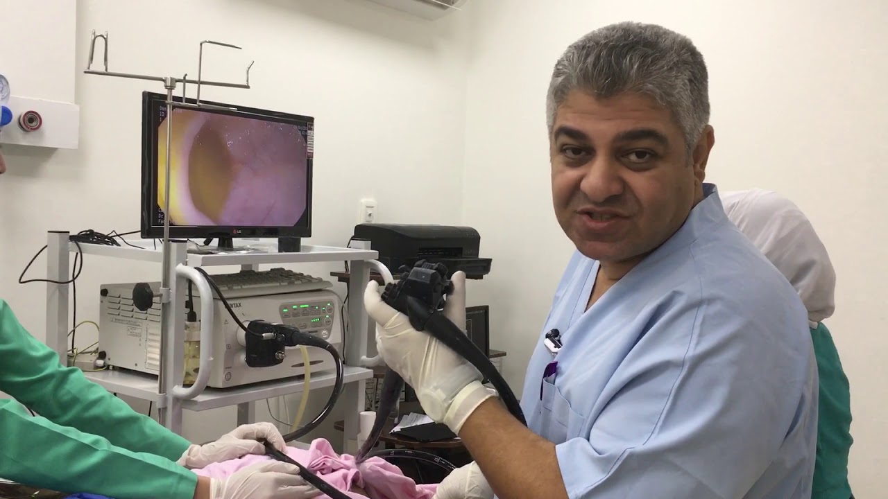 هل منظار القولون متعب