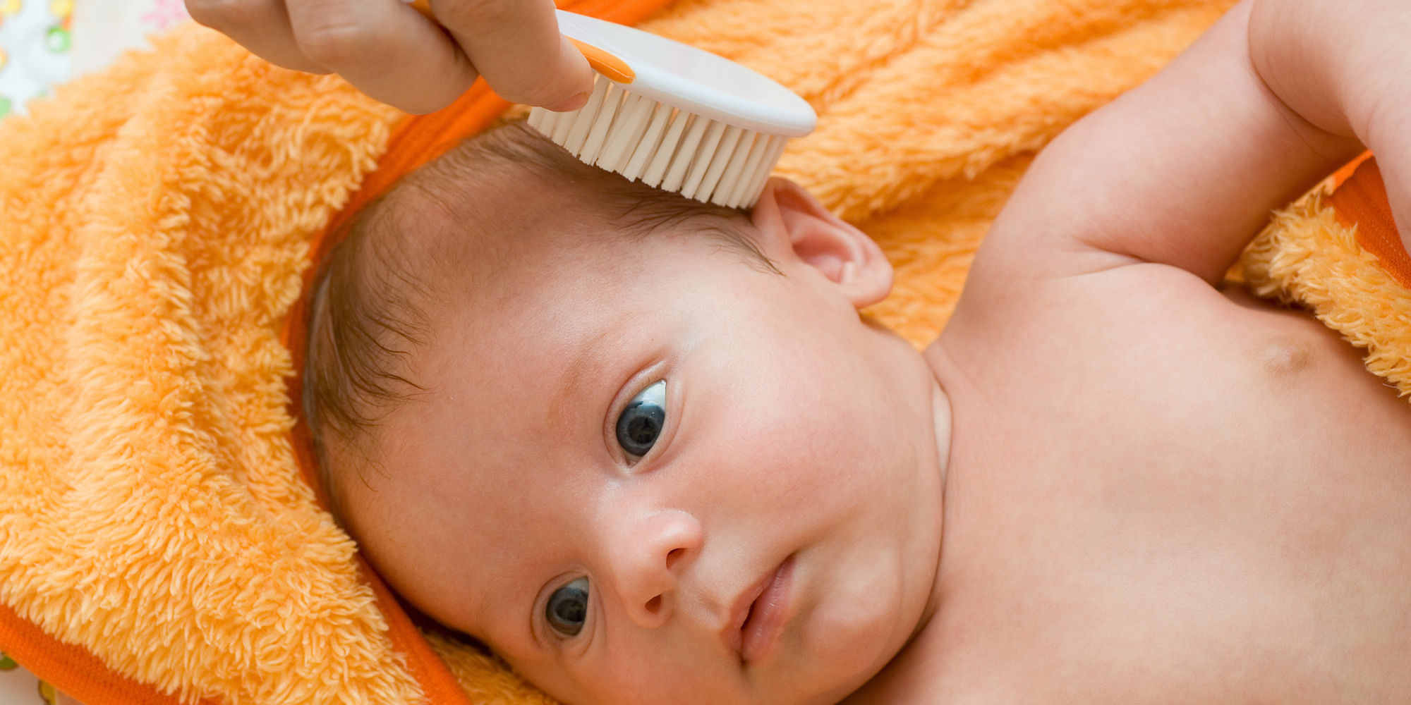 كيف أزيل قشرة رأس الرضيع