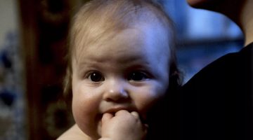 مضاعفات حساسية اللاكتوز عند الرضع