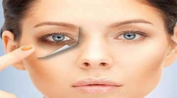 علاج الهالات السوداء تحت العين