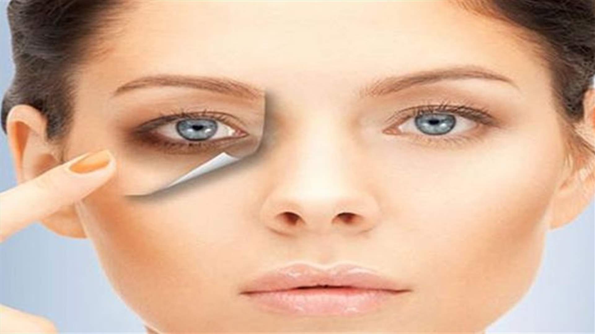 علاج الهالات السوداء تحت العين