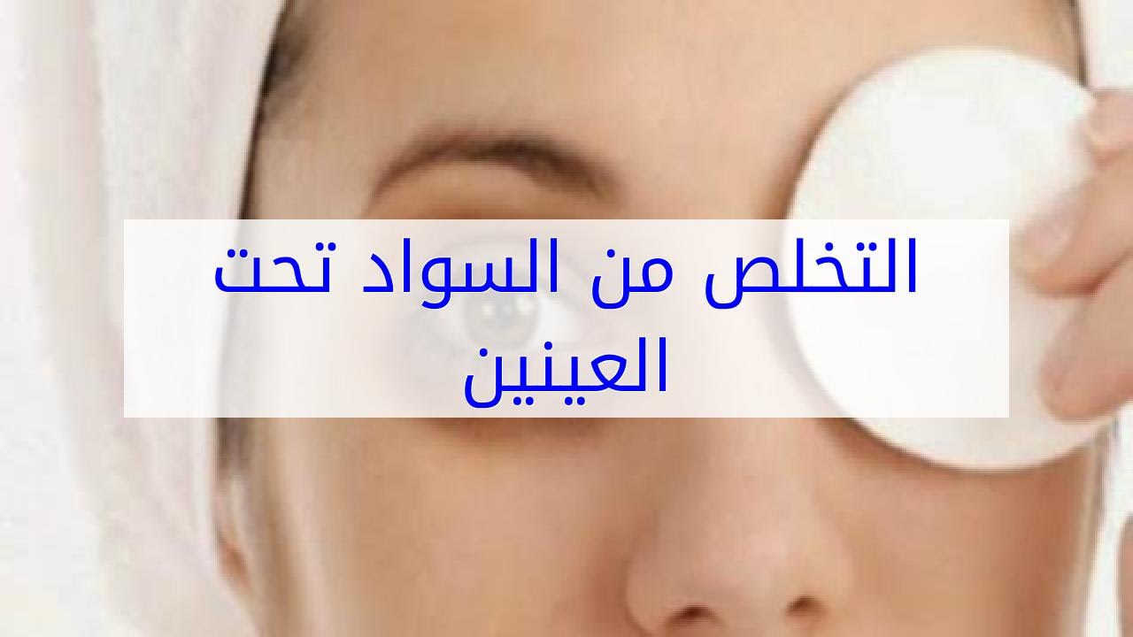 طريقة إزالة السواد تحت العين بسرعة