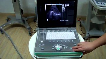 حمل الولد متى يبان بالتحليل