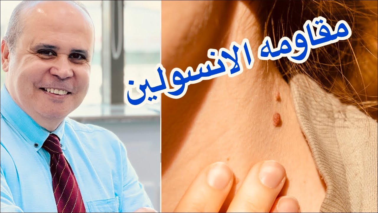 علاج مقاومة الأنسولين بالأكل