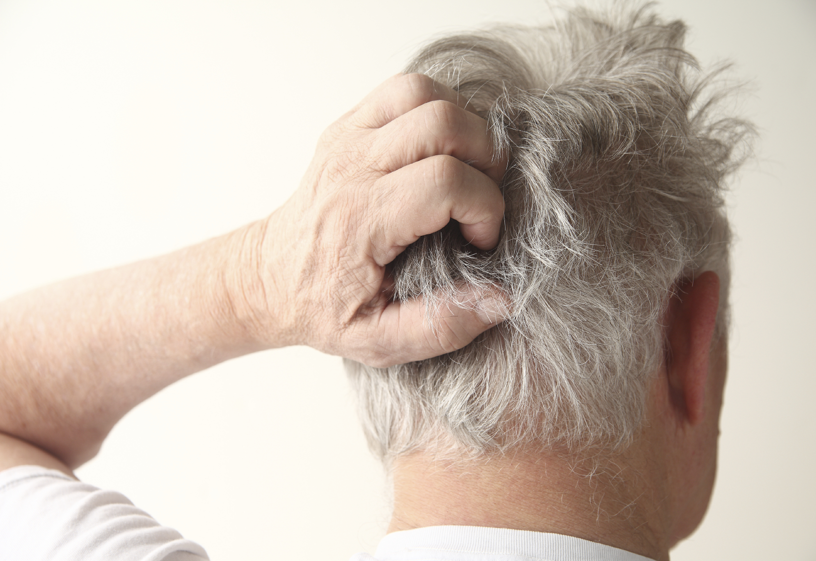 جل لعلاج صدفية الشعر