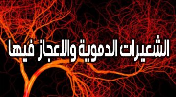 تجربتي مع الشعيرات الدموية