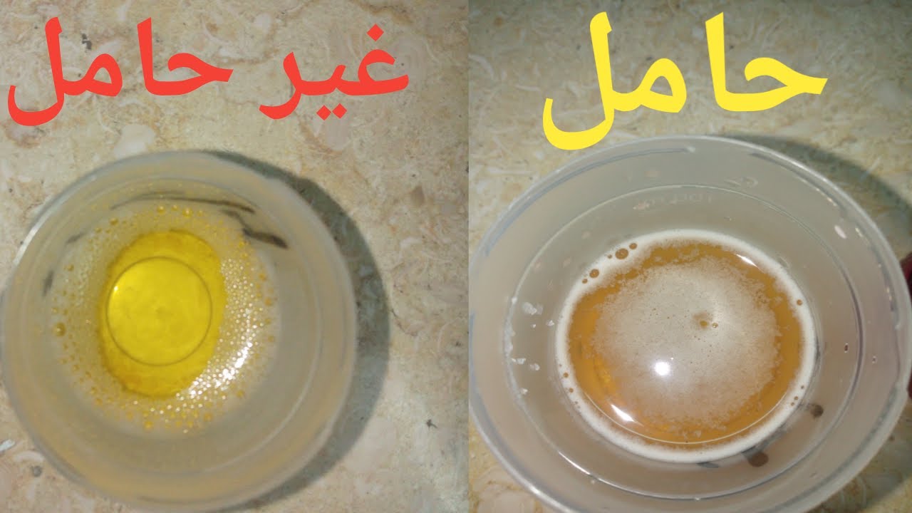 تحليل البول للحمل متى يبان ؟