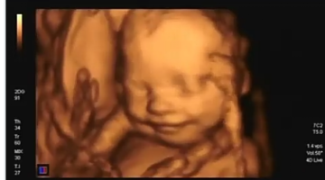 هل حركة الجنين الذكر نفضه