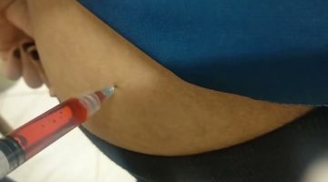 كيفية إعطاء الحقن للبنات