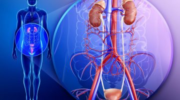 علاج التهاب المجاري البولية عند النساء