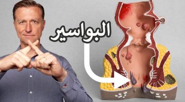 أعراض البواسير عند الرجال