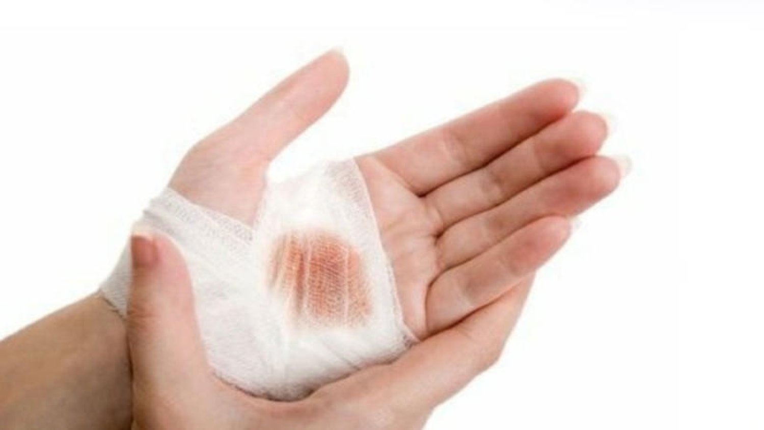 أدوية تساعد على التئام الجروح بسرعة