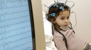 هل يمكن الشفاء من كهرباء المخ