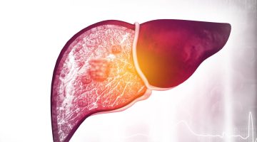 هل ارتفاع إنزيمات الكبد دليل على وجود فيروس؟