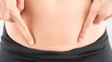 تفسير حلم البطن المجروح