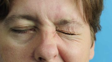 هل انخفاض الضغط يسبب تنميل في الوجه