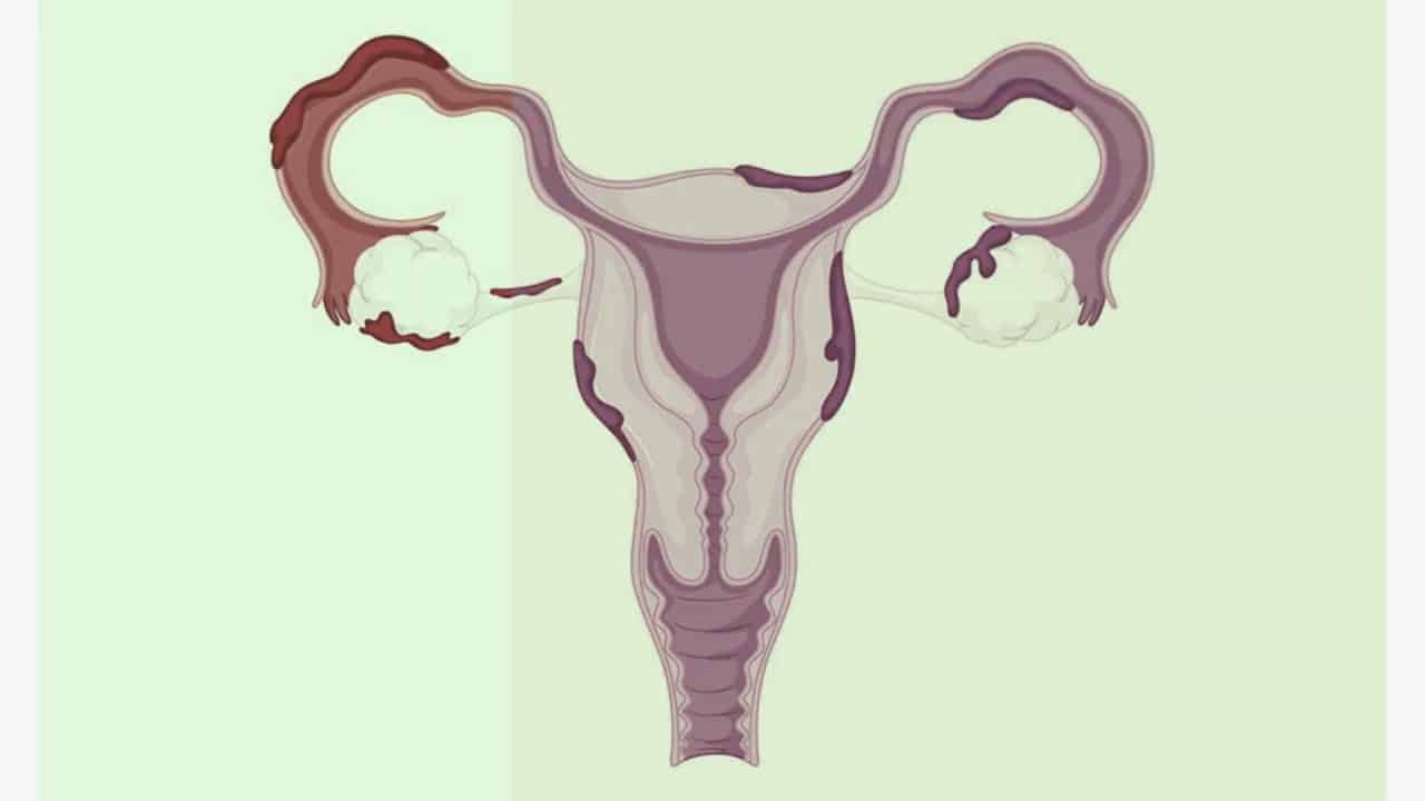 تجربتي مع سماكة بطانة الرحم والحمل