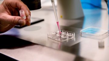 تجربتي مع صغر حجم البويضات