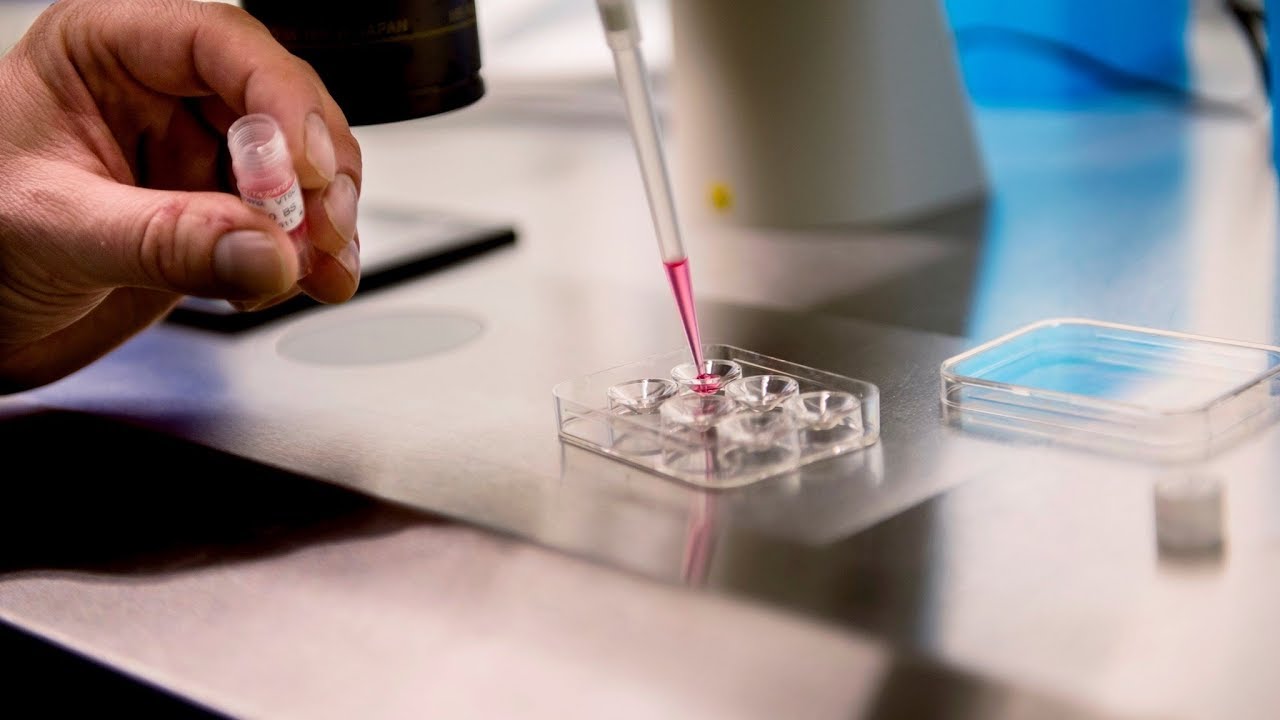 تجربتي مع صغر حجم البويضات