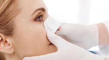 تصغير غضروف الأنف طبيعيا