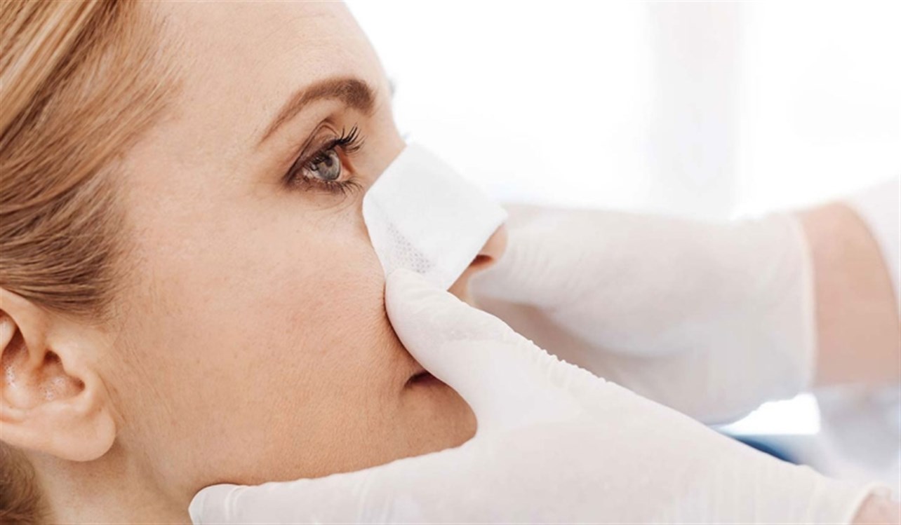 تصغير غضروف الأنف طبيعيا