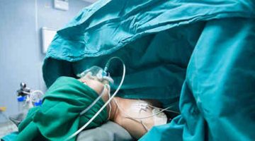 متى أنام على جنبي بعد العملية القيصرية