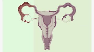 أعشاب تنزل الدورة في سن اليأس