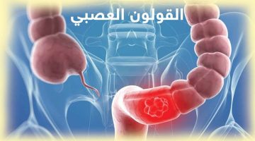 شفيت من القولون العصبي بالرقية