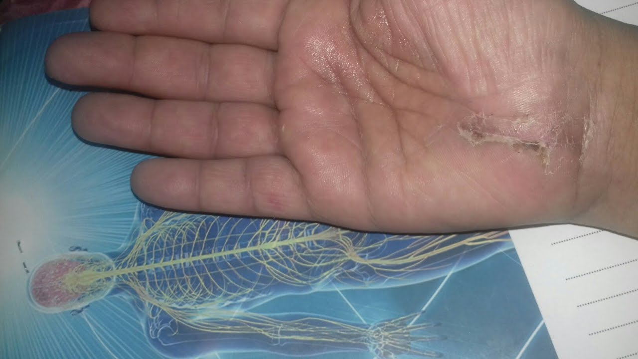 تفسير رؤية أصابع اليد اليسرى في المنام للمتزوجة