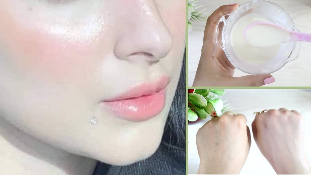 مكونات كريم سلامة الجهني للاكزيما