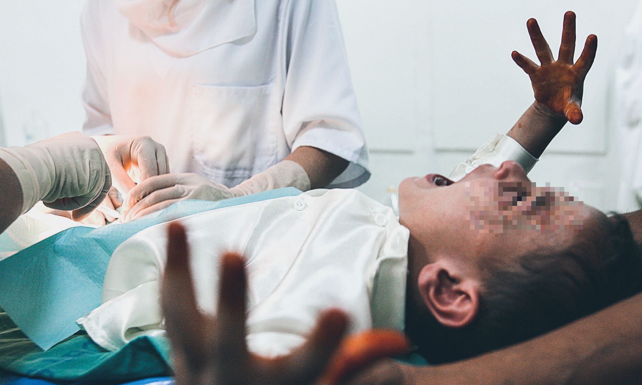 كيف أعرف أن ختان ابني صحيح بالصور