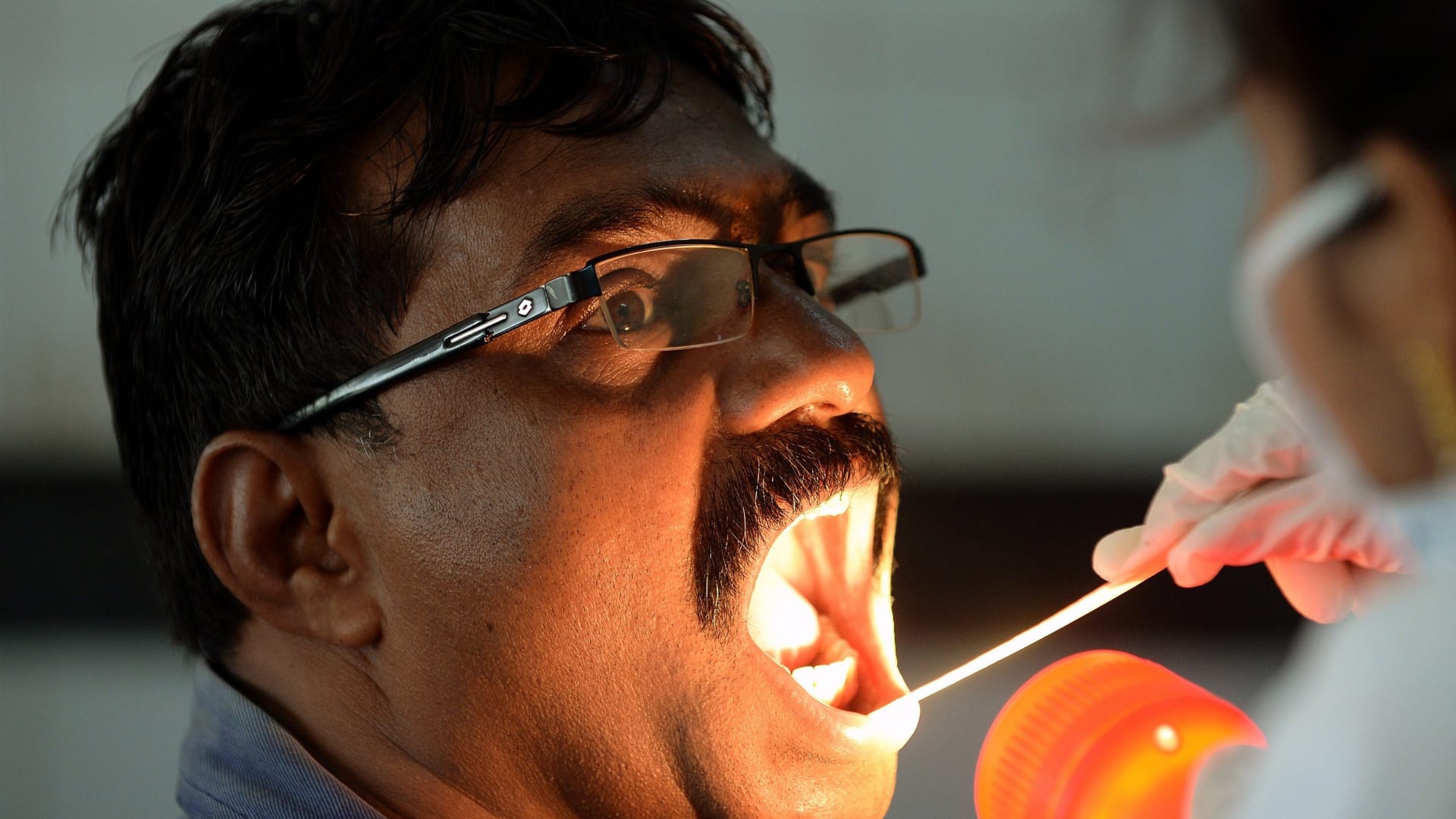 متى تظهر أعراض الإيدز في الفم وطرق العلاج