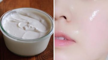 تجاربكم مع كريم ليزر وايت