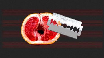 متى يلتئم جرح الختان بالليزر