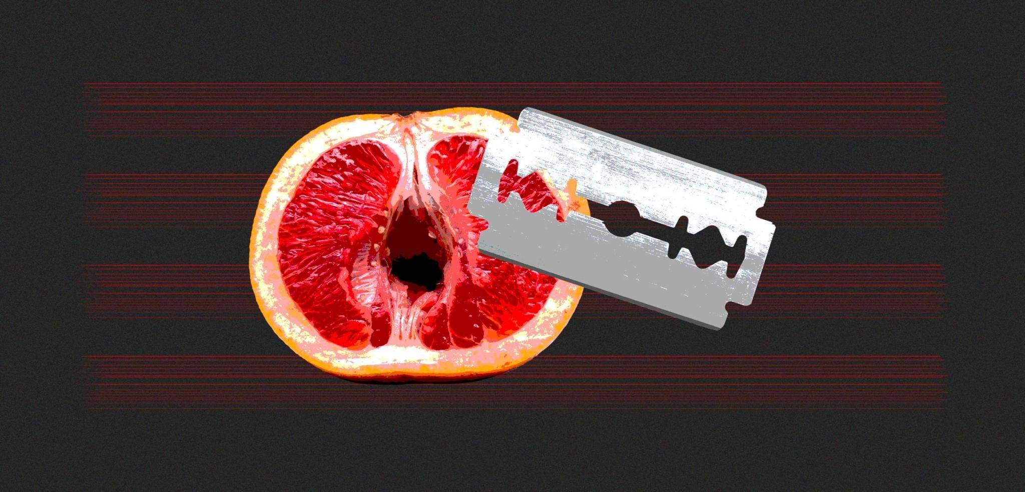 متى يلتئم جرح الختان بالليزر